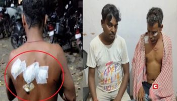 200 रुपये फीस बकाया रखने की सजा ! झोला छाप डॉक्टर ने मरीज को कैची से गोदा